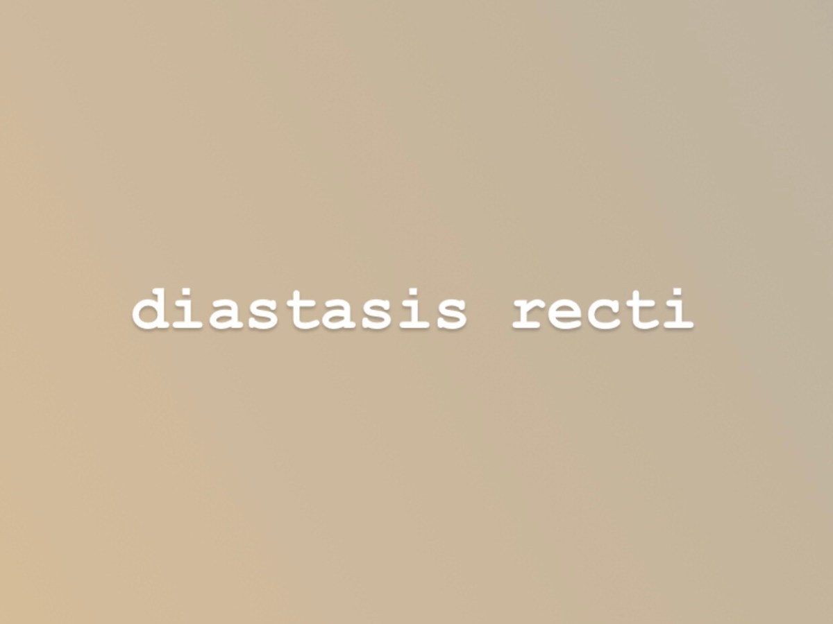 Diastasis Recti ﻿